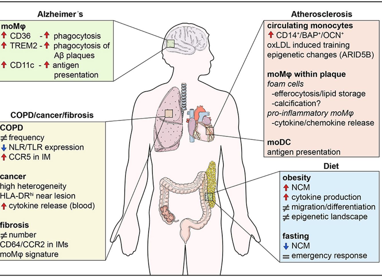 Human Monocyte Subsets and Phenotypes in Major Chronic Inflammatory Diseases - 